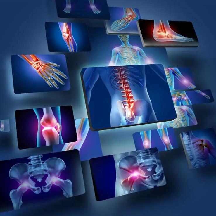 العلاج الطبيعي لعلاج الإصابات وتحسين الحركة في الكويت