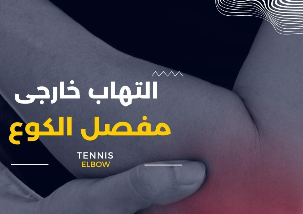علاج التهاب مفصل الكوع الخارجي في الكويت – تخفيف الألم وتحسين الحركة tennis elbow التهاب خارجي مفصل الكوع